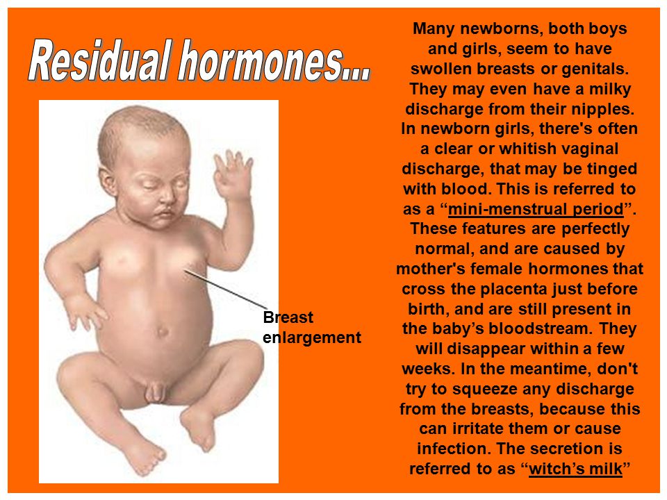 Infant swollen breast clearance